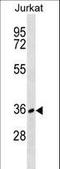 CD226 Molecule antibody, LS-C168526, Lifespan Biosciences, Western Blot image 