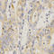 Mitogen-Activated Protein Kinase Kinase 6 antibody, LS-C332181, Lifespan Biosciences, Immunohistochemistry paraffin image 