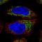 Ornithine Carbamoyltransferase antibody, NBP2-59039, Novus Biologicals, Immunofluorescence image 
