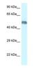 WD Repeat Containing, Antisense To TP73 antibody, NBP1-82413, Novus Biologicals, Western Blot image 