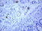Transmembrane Protein 173 antibody, LS-C174097, Lifespan Biosciences, Immunohistochemistry paraffin image 