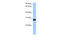 N-Ethylmaleimide Sensitive Factor, Vesicle Fusing ATPase antibody, 29-365, ProSci, Western Blot image 