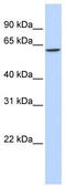 T-Box 22 antibody, TA345212, Origene, Western Blot image 