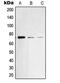 Spleen Associated Tyrosine Kinase antibody, MBS821993, MyBioSource, Western Blot image 