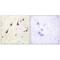 SUMO Specific Peptidase 7 antibody, A08121, Boster Biological Technology, Immunohistochemistry paraffin image 