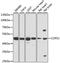 COP9 Signalosome Subunit 3 antibody, A7017, ABclonal Technology, Western Blot image 