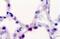 Prosurfactant Protein C antibody, MBS248306, MyBioSource, Immunohistochemistry paraffin image 