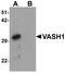 Vasohibin 1 antibody, A04402-2, Boster Biological Technology, Western Blot image 