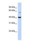 Phosphatidylinositol Glycan Anchor Biosynthesis Class K antibody, NBP1-69263, Novus Biologicals, Western Blot image 