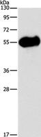 Amylase Alpha 2A (Pancreatic) antibody, PA5-50358, Invitrogen Antibodies, Western Blot image 