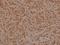 BCL2 Associated Agonist Of Cell Death antibody, A03520S136, Boster Biological Technology, Immunohistochemistry paraffin image 