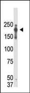PR/SET Domain 2 antibody, MA5-11144, Invitrogen Antibodies, Western Blot image 
