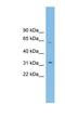 Solute Carrier Family 39 Member 9 antibody, NBP1-59841, Novus Biologicals, Western Blot image 