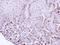 Transforming Acidic Coiled-Coil Containing Protein 2 antibody, NBP1-31221, Novus Biologicals, Immunohistochemistry paraffin image 