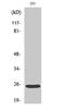 BCL2 Antagonist/Killer 1 antibody, STJ91814, St John