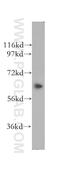 Kinesin Family Member 12 antibody, 12035-1-AP, Proteintech Group, Western Blot image 