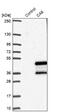Carbonic Anhydrase 6 antibody, NBP1-87537, Novus Biologicals, Western Blot image 