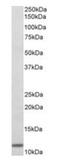 Beta-2-Microglobulin antibody, orb12337, Biorbyt, Western Blot image 