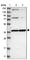 Mitochondrial Trans-2-Enoyl-CoA Reductase antibody, HPA022018, Atlas Antibodies, Western Blot image 