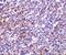 Interleukin 27 Receptor Subunit Alpha antibody, A03654, Boster Biological Technology, Immunohistochemistry paraffin image 