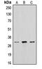 Cathepsin A antibody, MBS820402, MyBioSource, Western Blot image 