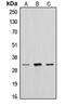 Cathepsin A antibody, MBS820402, MyBioSource, Western Blot image 