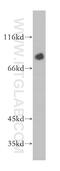 Palmdelphin antibody, 16531-1-AP, Proteintech Group, Western Blot image 