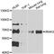 Interleukin 1 Receptor Associated Kinase 3 antibody, A13402, ABclonal Technology, Western Blot image 