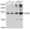 Proteasome Subunit Beta 6 antibody, A4053, ABclonal Technology, Western Blot image 
