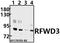 E3 ubiquitin-protein ligase RFWD3 antibody, A09738-1, Boster Biological Technology, Western Blot image 