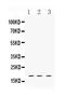 LIM Domain Only 1 antibody, A06093-1, Boster Biological Technology, Western Blot image 