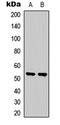 Serum/Glucocorticoid Regulated Kinase 1 antibody, LS-C358312, Lifespan Biosciences, Western Blot image 