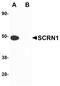 Secernin 1 antibody, 5849, ProSci, Western Blot image 