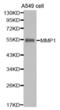 Matrix Metallopeptidase 1 antibody, abx004027, Abbexa, Western Blot image 