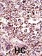 Ribophorin II antibody, 61-383, ProSci, Immunohistochemistry paraffin image 