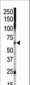 Casein Kinase 1 Gamma 2 antibody, LS-C100601, Lifespan Biosciences, Western Blot image 