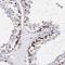 Ring Finger And WD Repeat Domain 3 antibody, FNab07257, FineTest, Immunohistochemistry frozen image 