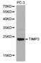 TIMP Metallopeptidase Inhibitor 3 antibody, LS-C192917, Lifespan Biosciences, Western Blot image 