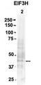 Eukaryotic Translation Initiation Factor 3 Subunit H antibody, TA339678, Origene, Western Blot image 