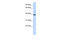 Chitinase Acidic antibody, 25-786, ProSci, Western Blot image 