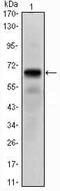 Parathyroid Hormone 1 Receptor antibody, MA5-15676, Invitrogen Antibodies, Western Blot image 