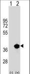 Palmitoyl-Protein Thioesterase 1 antibody, LS-B12963, Lifespan Biosciences, Western Blot image 