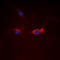 Forkhead Box O1 antibody, LS-C356047, Lifespan Biosciences, Immunofluorescence image 