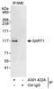 Spliceosome Associated Factor 1, Recruiter Of U4/U6.U5 Tri-SnRNP antibody, A301-422A, Bethyl Labs, Immunoprecipitation image 