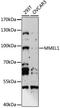 Membrane Metalloendopeptidase Like 1 antibody, LS-C750160, Lifespan Biosciences, Western Blot image 