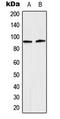 Signal Transducer And Activator Of Transcription 5A antibody, LS-C354261, Lifespan Biosciences, Western Blot image 