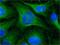 Tubulin beta-1 chain antibody, NB120-11312, Novus Biologicals, Immunocytochemistry image 