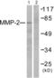 Matrix Metallopeptidase 2 antibody, abx013147, Abbexa, Western Blot image 