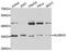 AlkB Homolog 3, Alpha-Ketoglutaratedependent Dioxygenase antibody, A5808, ABclonal Technology, Western Blot image 