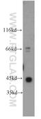 Actin Gamma 1 antibody, 11227-1-AP, Proteintech Group, Western Blot image 
